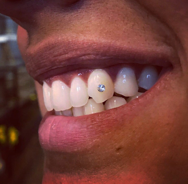 Grillz, Grills, Teeth Grill,  tooth bling, dental grill, teeth grillz, teeth diamonds