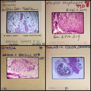 Peut inclure: Quatre lames microscopiques d'échantillons de tissus. La lame supérieure gauche montre un diagnostic de myopathie. La lame supérieure droite est étiquetée "Herpes esophagus". La lame inférieure gauche montre "Nerve = Bacilli AFB". La lame inférieure droite montre "Colon, Divertic".