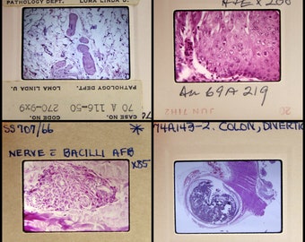 25 microscope images - Vintage 35mm Slides - cells - microbes - parasites - scientific - medical oddities - vintage slides