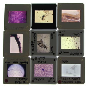 May include: A collection of nine square microscope slides arranged in a grid. Each slide features a unique biological specimen, including purple stained tissue, dark cellular clusters, and blood cells, with handwritten labels on the white borders.
