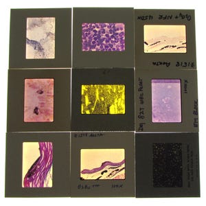 May include: A grid of nine square photographic slides featuring various microscopic biological tissue samples. Each slide is mounted in a gray frame with handwritten labels including text like Z1518 Aorta, OsO4+NFR 450x, and EM Block, displaying diverse cellular structures in shades of purple, yellow, and black.