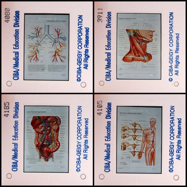 25 Medical Slides - vintage 35mm Photo Slides - CIBA Anatomical Illustrations - Medical Oddities Curiosities - Macabre - creepy
