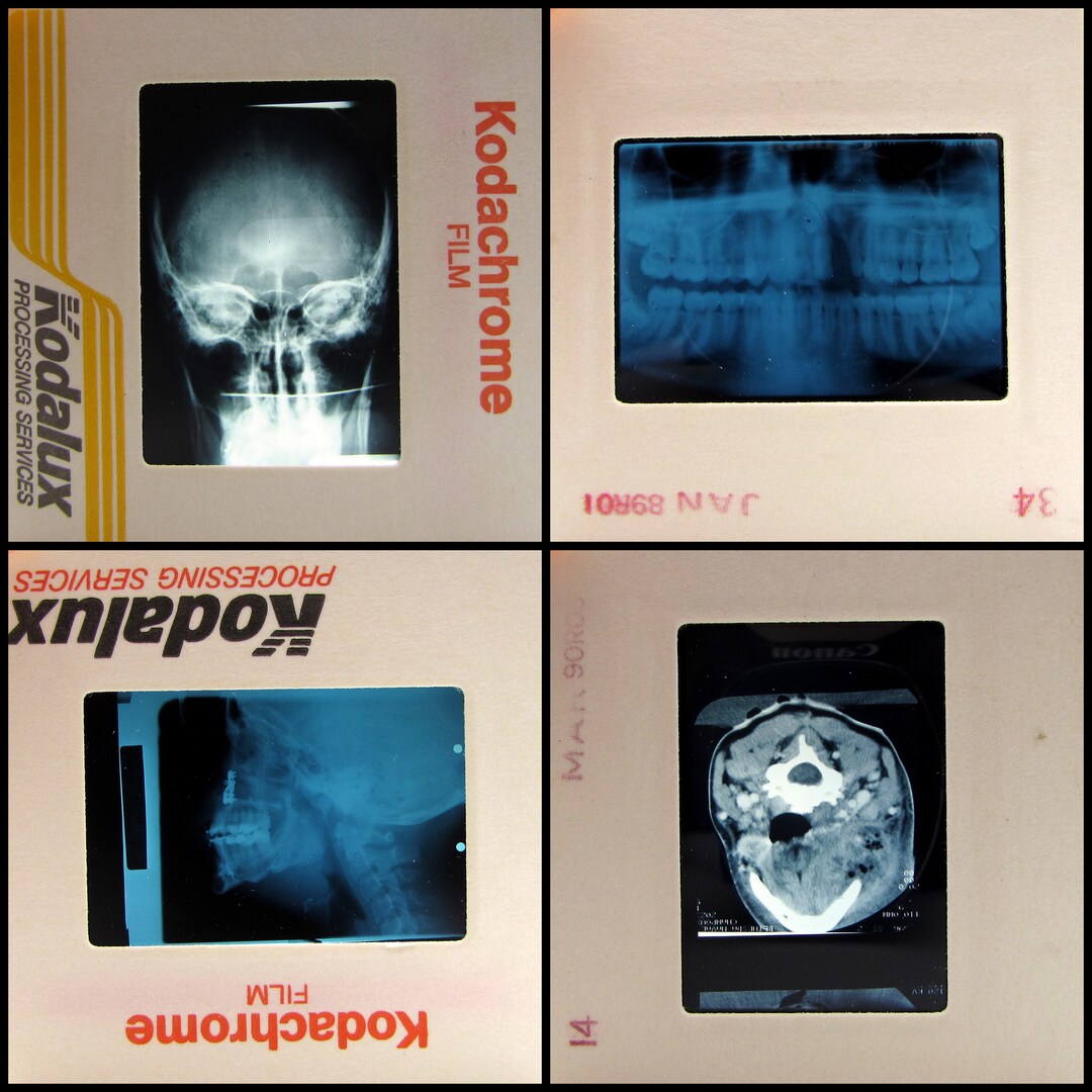 15 Teeth Xray Slides Vintage 35mm Photo Slides Dental Etsy
