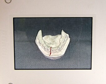 14 Dental Casts Slides - vintage 35mm Photo Slides - Teeth - Medical Oddities Curiosities Photographs - Macabre - Anatomy - creepy