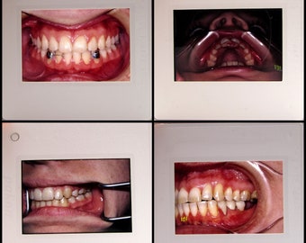25 Teeth Slides - vintage 35mm Photo Slides - Dental - Medical Oddities Curiosities Photographs - Macabre - Anatomy - creepy