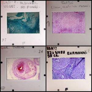 25 microscope images - Vintage 35mm Slides - cells - microbes - scientific - science class - medical oddities - vintage slides