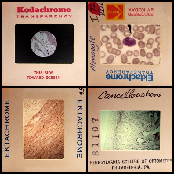 25 Microscope Images Vintage 35mm Slides Cells Microbes Etsy