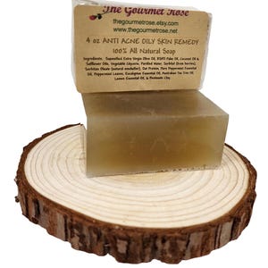May include: A 4 oz bar of anti-acne, oily skin remedy soap, labeled as 100% all-natural. The soap is a light brown color and rests on a wooden slice. The label includes the brand name and website.