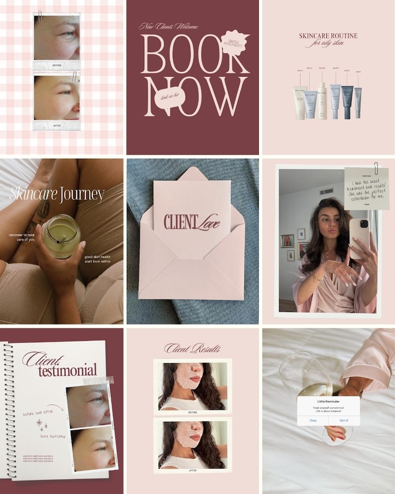 Esthetician Social Media Templates Canva | Skincare Instagram Posts ...