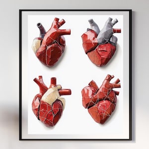 Anatomical Heart Wall Art 2 – Vintage Medical Illustration Set, Red and White Human Heart Print, Digital Download for Medical Office Decor