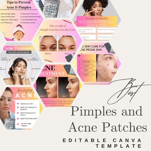 May include: A collage of images promoting acne patches. The images show before and after photos of people using the patches, as well as close-ups of the patches themselves. The text on the images includes "Pimple Patches for the Face", "Acne Treatment", "Skin Care for Acne Prone Skin", and "How to get rid of Acne".