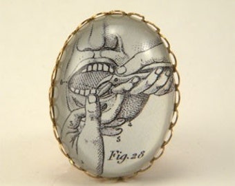 Pulling Teeth Vintage Dental Engraving Cocktail Ring