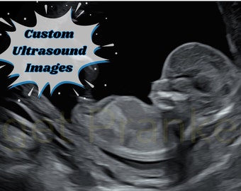 Prank pregnancy custom real ultrasound image pregnancy joke funny gift idea for boyfriend fake ultrasound picture baby hoax not expecting