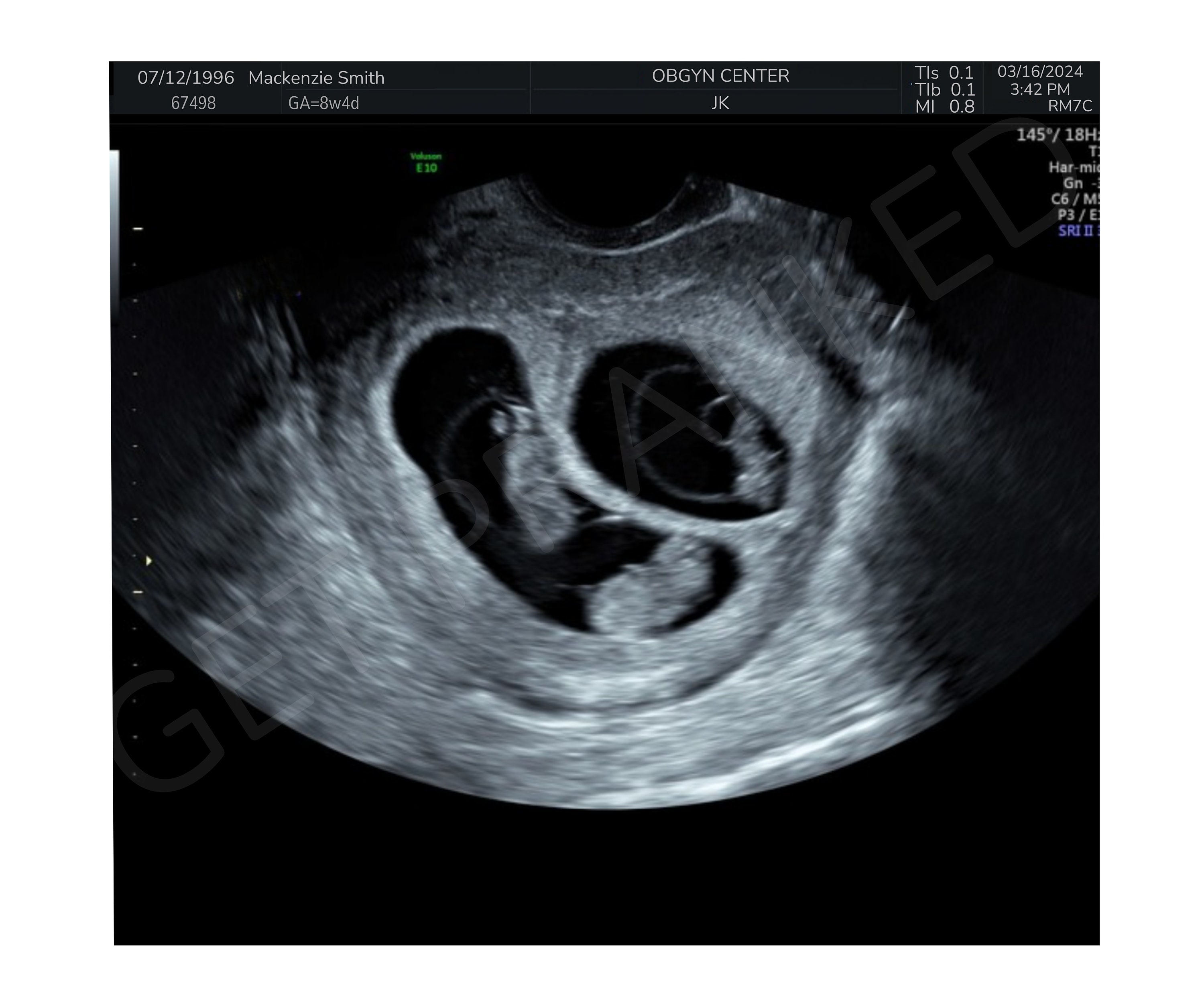 Fake Ultrasound Prank - ikp476j