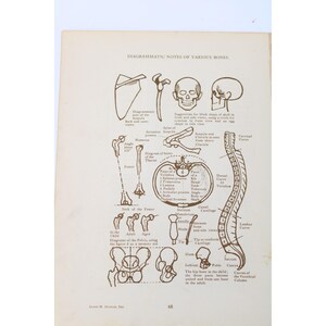 Könnte beinhalten: Ein anatomischer Vintage-Druck mit dem Titel DIAGRAMMATIC NOTES OF VARIOUS BONES, der braune Strichzeichnungen menschlicher Skelettstrukturen zeigt, darunter Schädel, Schulterblatt, Oberschenkelknochen, Wirbel und Becken mit detaillierten Beschriftungen.