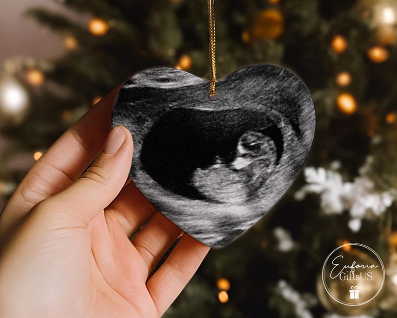 Baby Memorial Ornament, Miscarriage Ornament, Stillbirth Keepsake, Sympathy Gift, Baby Loss Ornament, Loss Of Baby Gift, Baby Ultrasound image 8
