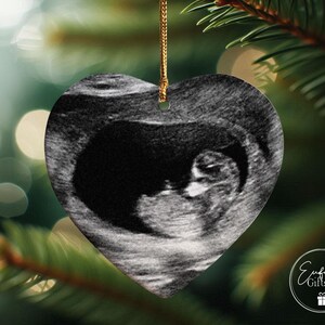 Baby Memorial Ornament, Miscarriage Ornament, Stillbirth Keepsake, Sympathy Gift, Baby Loss Ornament, Loss Of Baby Gift, Baby Ultrasound image 6