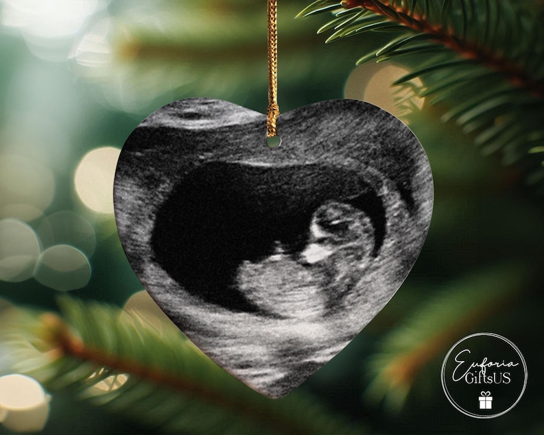 Baby Memorial Ornament, Miscarriage Ornament, Stillbirth Keepsake, Sympathy Gift, Baby Loss Ornament, Loss Of Baby Gift, Baby Ultrasound image 6