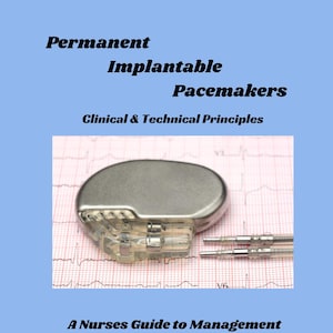 Marcapasos implantables permanentes (MPP) y DCI: principios clínicos y técnicos de la estimulación