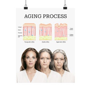 Verouderingsproces Huidveranderingen Stadia Matte verticale poster, plastische chirurgie MedSpa verpleegkundige injector decor, consultatietool schoonheidsspecialiste