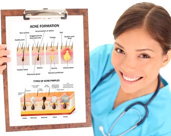 Acne Formation Digital Download, Aesthetic Clinic Dermatologist Beauty Salon Consultation Tool Wall Display, Training Poster Digital File