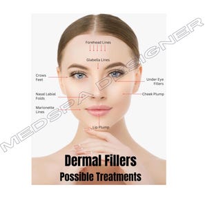 Dermal Filler Possible Treatments Poster, MedSpa Nurse Injector Decor, Esthetician Consultation Tool