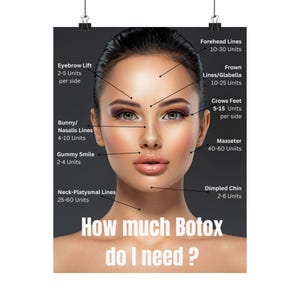 Botox Dosage Guide Poster, Aesthetic Decor, Beauty Clinic Wall Art, Skincare Studio Decor, Spa Treatment Guide