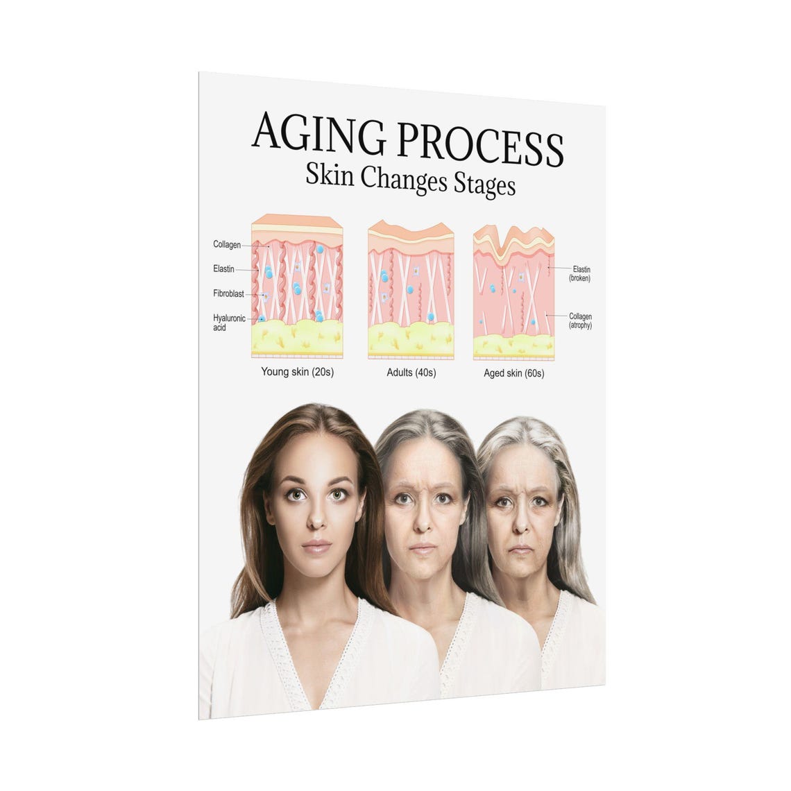 Aging Process Skin Changes Stages Rolled Poster, Face Lift Med Spa ...