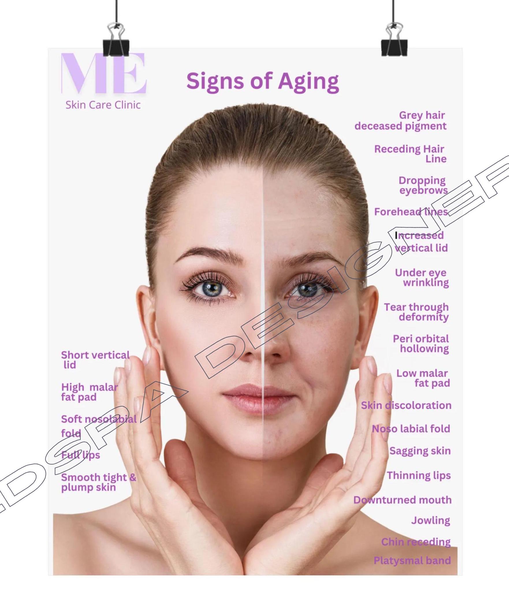 Customized With Logo Signs of Aging Poster, Esthetician Consultation ...