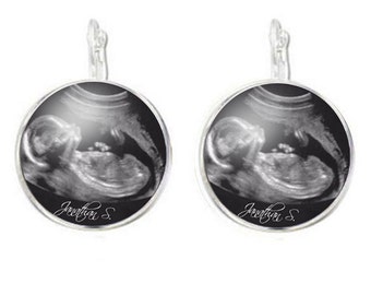 Sonogram Earrings, Sonogram Jewelry, Ultrasound Earrings, Pregnancy Gift , New Baby Earrings, birth announcement