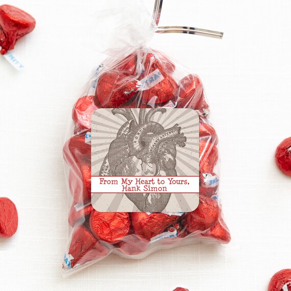 Il_570xn
