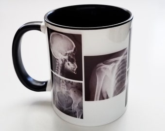 Xray Technician Mug medical radiologist doctor nurse graduation gift physician assistant student teacher goth imaging student teacher cup