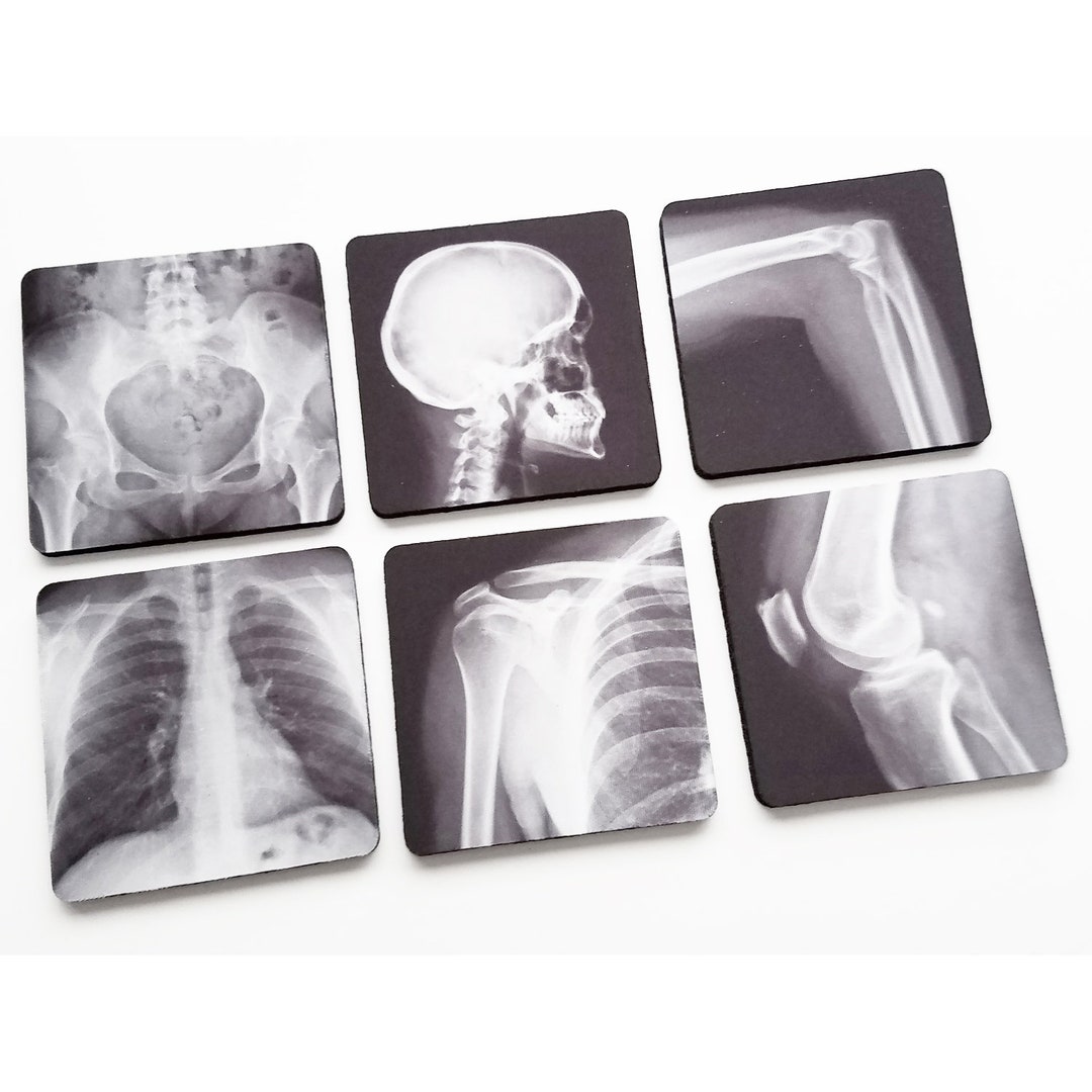 Radiologue cadeau radiographie sous-verres ensemble anatomie médicale imagerie technicien coude genou bassin poitrine crâne remise des diplômes