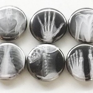 May include: Six round buttons with black backgrounds and white x-ray images of different body parts, including a hand, a spine, a chest, a foot, and an arm.