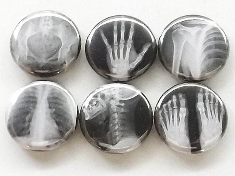 May include: Six round buttons with black backgrounds and white x-ray images of different body parts, including a hand, a spine, a chest, a foot, and an arm.