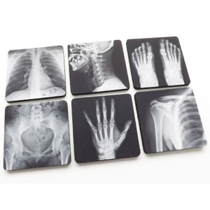 Radiology Coasters gift set medical anatomy xray imaging doctor nurse hand foot pelvis chest spine radiologist graduation party favors goth