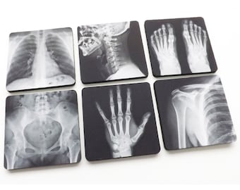 Radiology Coasters gift set medical anatomy xray imaging doctor nurse hand foot pelvis chest spine radiologist graduation party favors goth