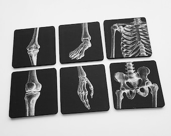 Joints Drink Coasters medical gift set anatomy ortho doctor nurse school graduation party favor goth md rn pa