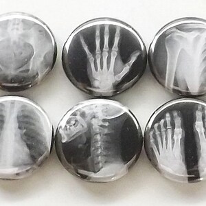May include: Six black and white round buttons with different x-ray images of bones. The images include a hand, a rib cage, a spine, and feet.