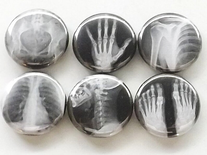 May include: Six black and white round buttons with different x-ray images of bones. The images include a hand, a rib cage, a spine, and feet.
