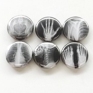 May include: Six round buttons with black and white x-ray images of bones, including a hand, feet, spine, and ribs.