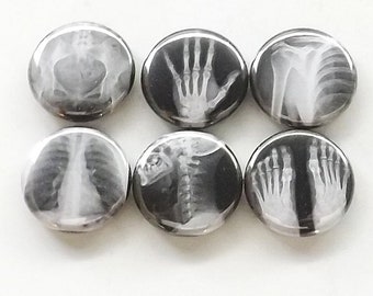 Radiology Magnet Gift radiologist graduation party favor hand foot pelvis lungs spine nurse doctor technician physician assistant button pin