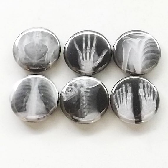 Radiology Magnet Gift radiologist graduation party favor hand foot pelvis lungs spine nurse doctor technician physician assistant button pin