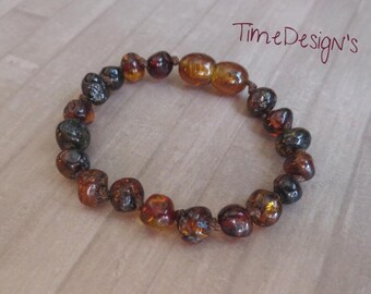 amber bracelet for colic