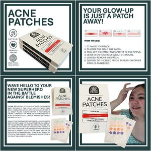Fast Healing Patch,Pimple Patch,Hydrocolloid Patch,Acne Patch,Zit Patch,Sensitive Skin Patch,Skincare Routine,Drug-Free Acne Care,Non-Drying