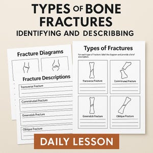 Puede incluir: Dos hojas de papel blancas con diagramas y descripciones de fracturas óseas. La hoja superior dice "TYPES OF BONE FRACTURES IDENTIFYING AND DESCRIBBING". La hoja inferior tiene el texto "DAILY LESSON".