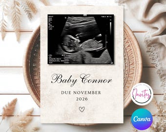 Editable Modern Minimalist Pregnancy Announcement Template, Baby Reveal, Digital Social Media Reveal, Neutral Baby Announcement Ideas