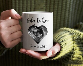 Personalized Sonogram Mug: Custom Baby Announcement Coffee Mug