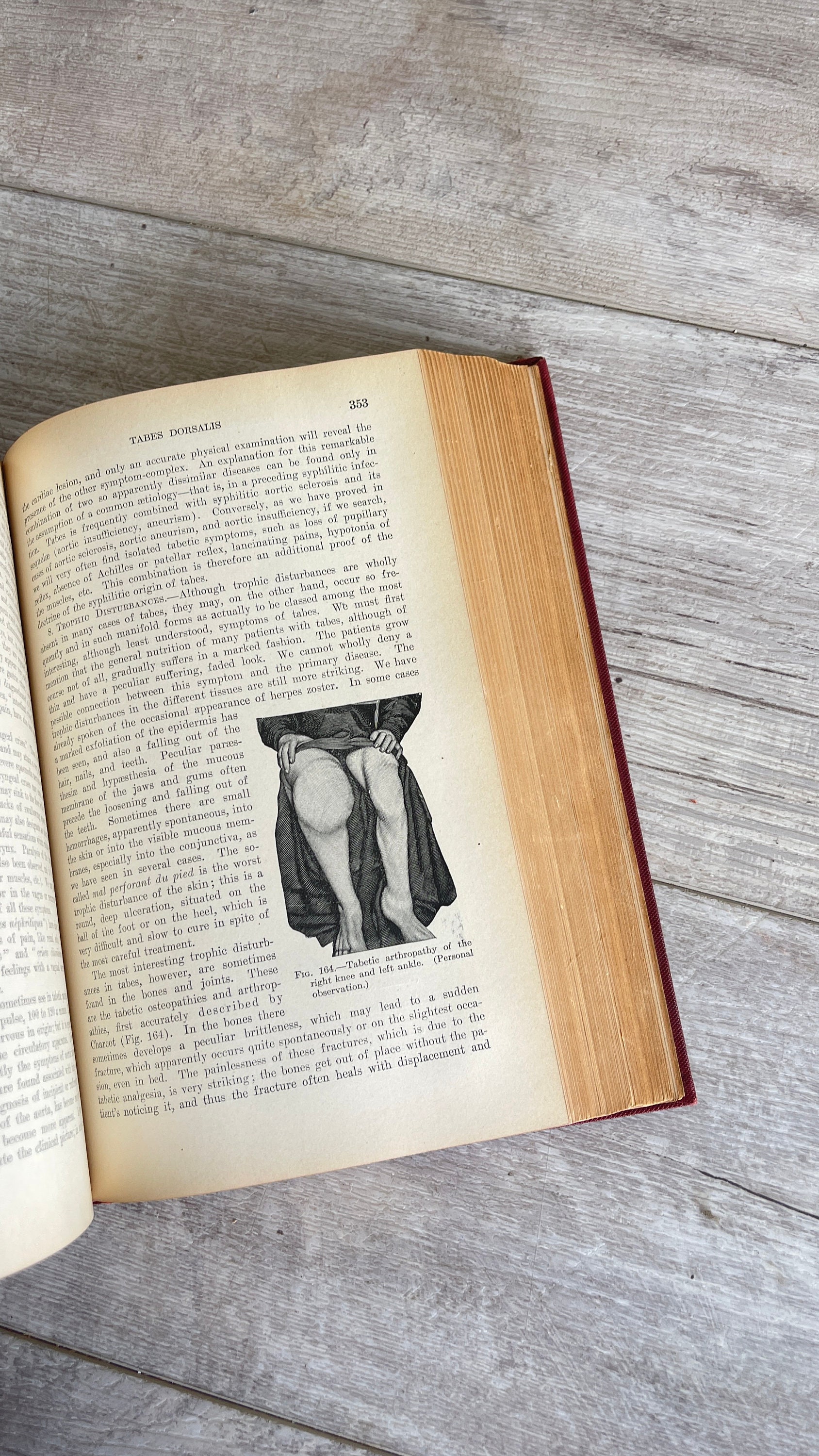 Antique Medical -textbook of Medicine for Students and
