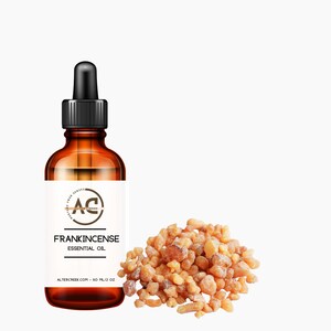 Frankincense Essential Oil